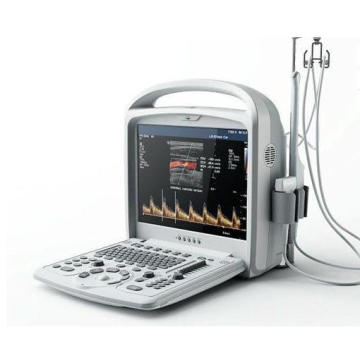 High Grade Color Doppler Ultrasound Diagnostic System